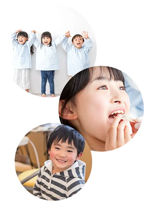 急速拡大装置