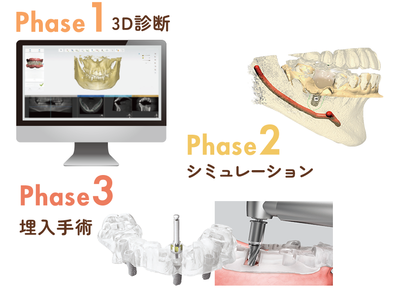 ガイドシステム