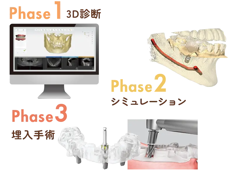 ガイドシステム