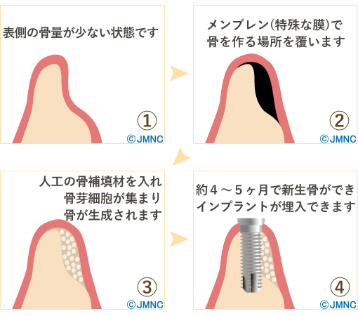正確かつ安全な手術