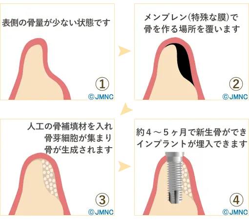 正確かつ安全な手術