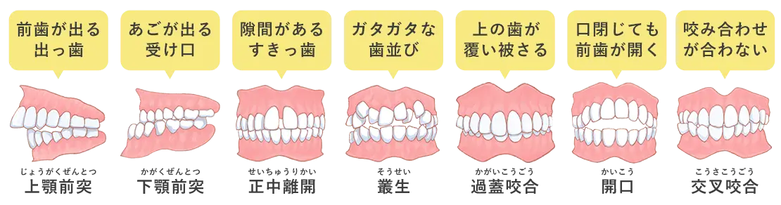 矯正歯科